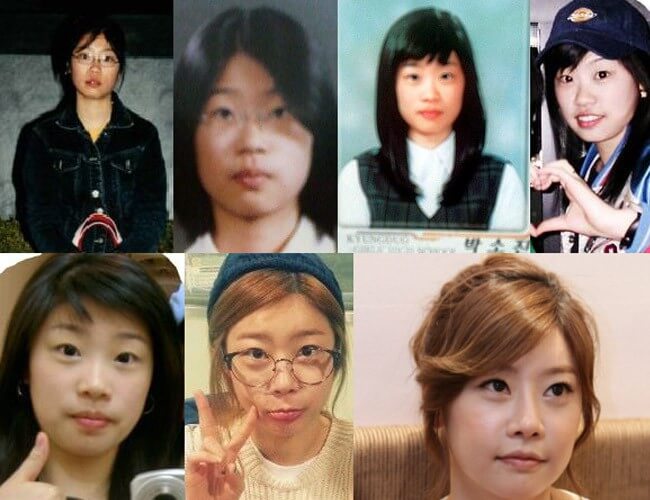 Sau phẫu thuật thẩm mỹ, cô nàng trưởng nhóm Girl' day ngày càng trẻ trung và xinh đẹp dù ở độ tuổi 32.