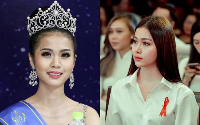 Hoa hậu Kim Ngọc phẫu thuật thẩm mỹ