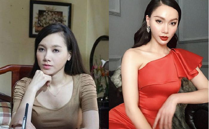 MC Minh Hà phẫu thuật thẩm mỹ