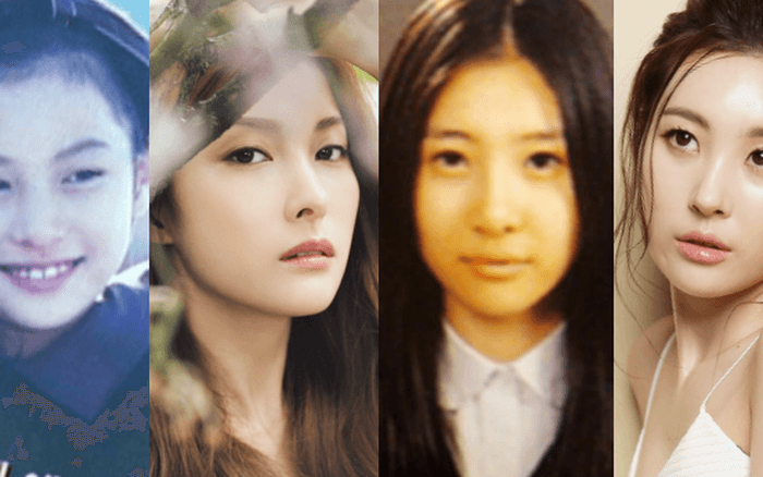 Những người đẹp Kpop dính nghi án phẫu thuật thẩm mỹ