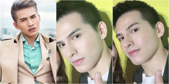 Quốc Thiên phẫu thuật thẩm mỹ