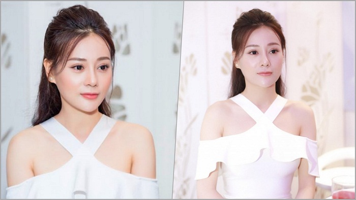 Phương Oanh đã phẫu thuật thẩm mỹ