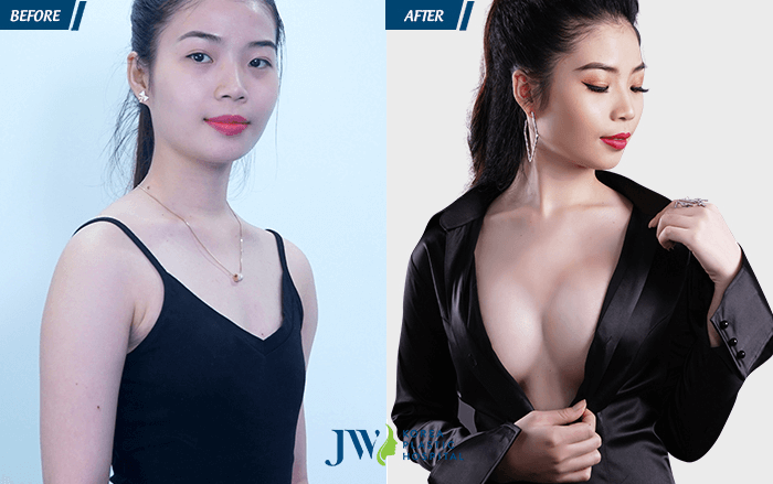 Hot girl Bùi Yến Nhi sở hữu bầu ngực căng tròn