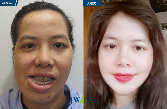 thuy-hang