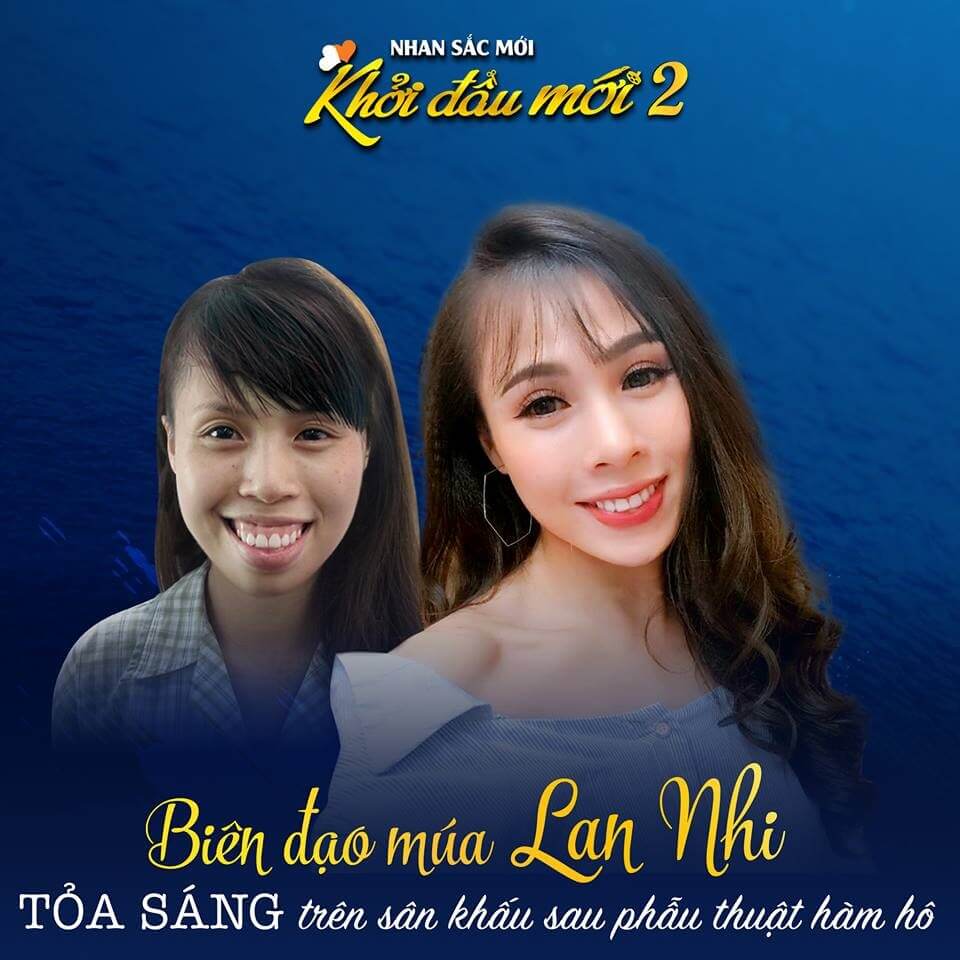 Biên đạo múa Lan Nhi Biên đạo múa Lan Nhi