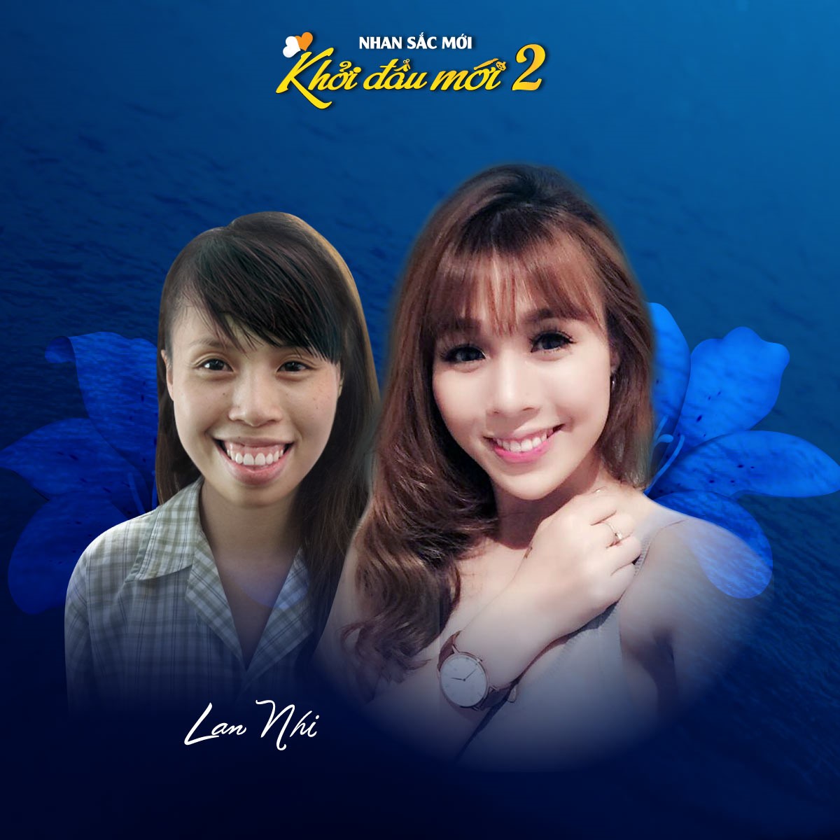 Biên đạo múa Lan Nhi