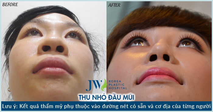 review-thu-gon-canh-mui-o-dau-dep-va-uy-tin-7