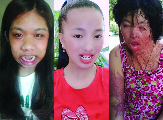 Nỗi đau tột cùng của các thí sinh Nhan sắc mới - Khởi đầu mới
