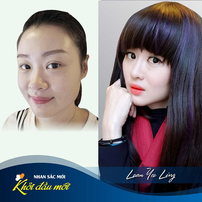 lam-thon-gon-dau-mui-tai-jw-gia-bao-nhieu-1