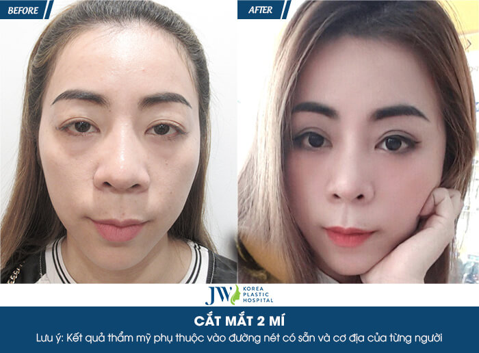 cat-mat-hai-mi-2