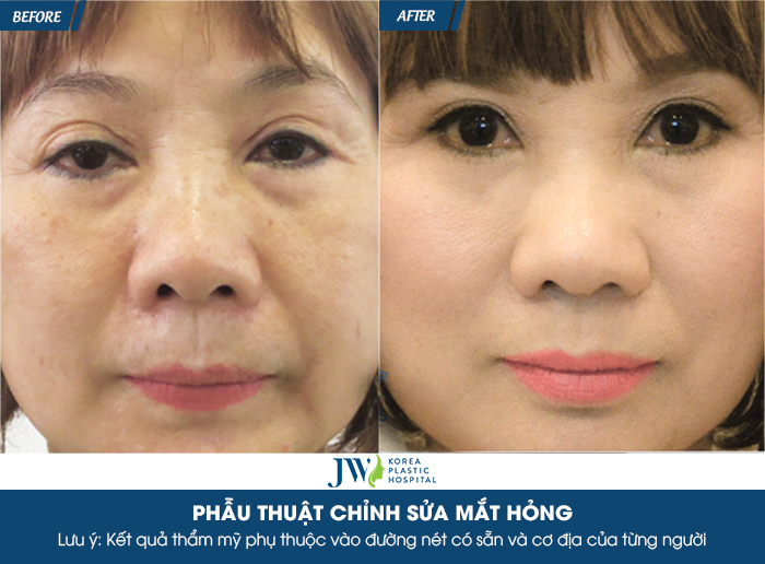 cat-mi-qua-to-co-sua-duoc-khong-chua-bang-cach-nao-4