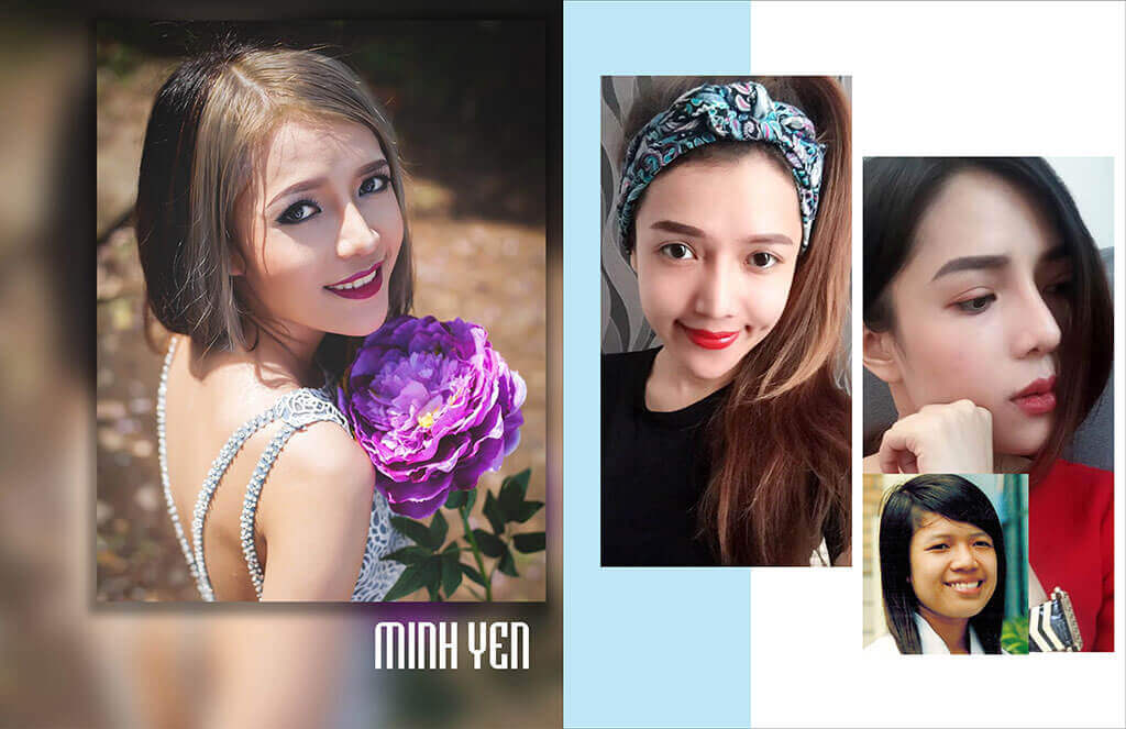 quy-trinh-phau-thuat-thao-song-mui-va-cach-cham-soc-hau-phau-10