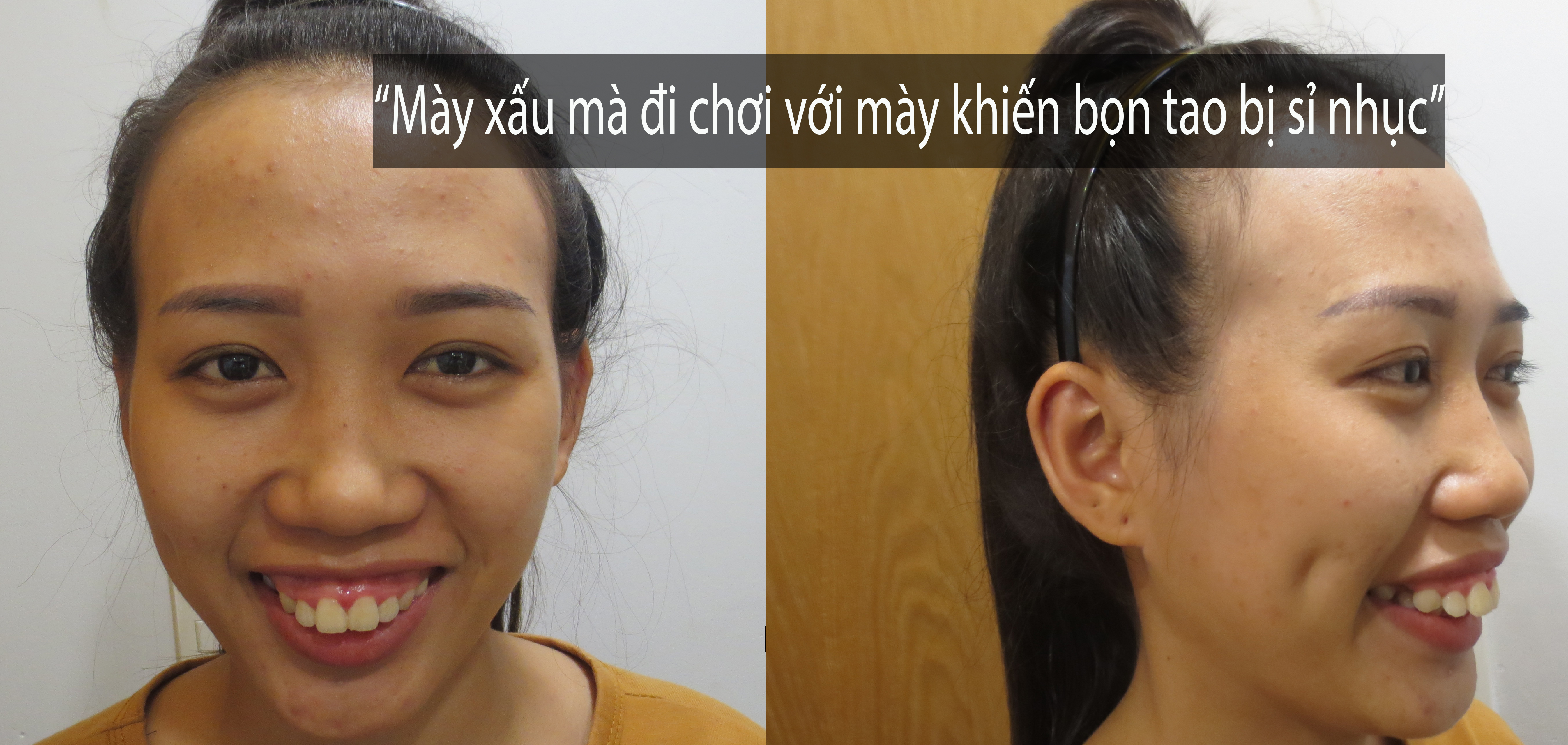 thời đại vẻ đẹp lên ngôi