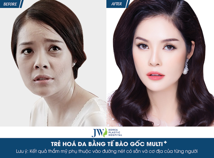 duong cam linh1