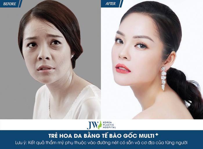 Giải mã bí mật tế bào gốc có tác dụng gì?_5