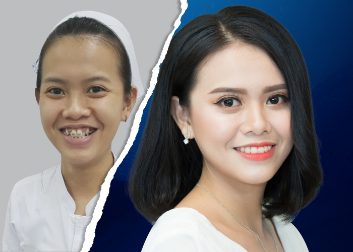 phẫu thuật thẩm mỹ miễn phí