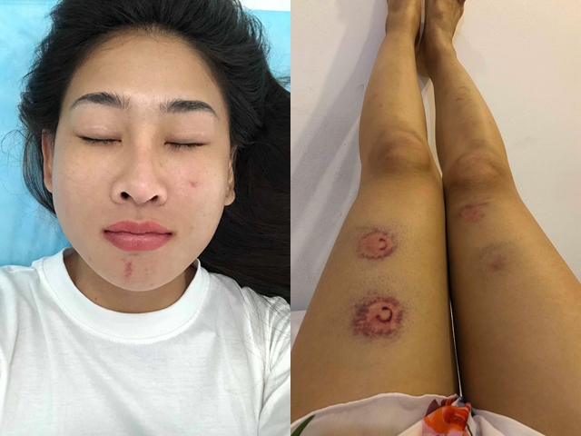 chien-binh-dj-oxy-my-nhan-hanh-dong-thu-nhan-tung-sua-mui-voi-bac-si-tu-dung-2