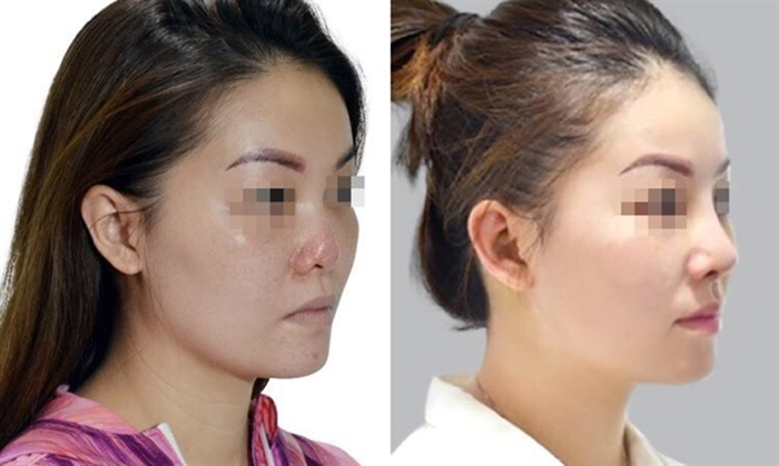 Chuyên gia thế giới nói gì về xu hướng thẩm mỹ tại Việt Nam - hình 6