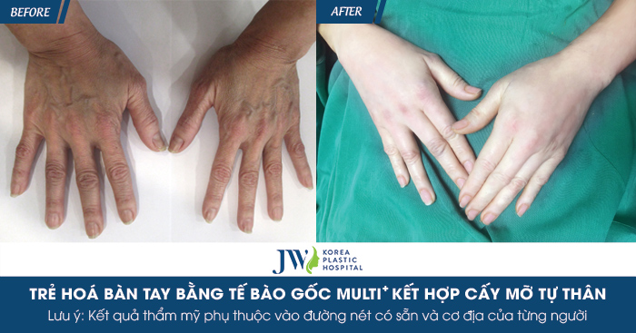 cay-mo-tu-than-o-dau-an-toan-5-tieu-chi-danh-gia-khong-the-bo-lo-10