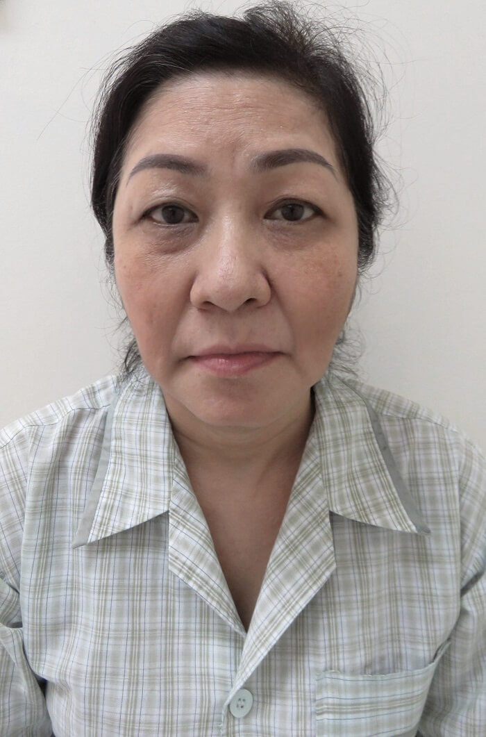 https://thammyhanquoc.vn/ca-si-dong-quan-vo-oa-truoc-nu-cuoi-tuoi-tre-cua-nguoi-phu-nu-u50-1