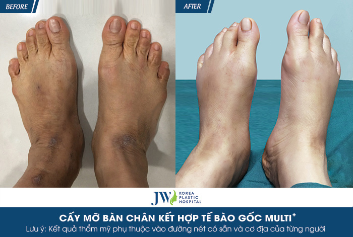 cay-mo-tu-than-o-dau-an-toan-5-tieu-chi-danh-gia-khong-the-bo-lo-9
