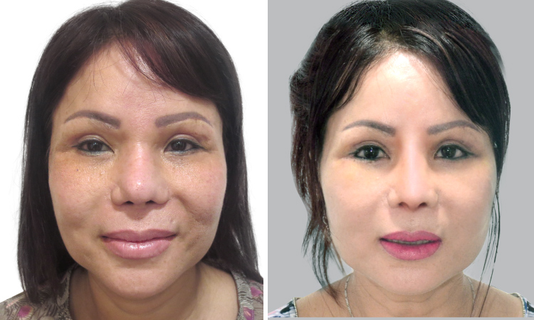 Chân dung vị bác sĩ cứu chữa thành công hàng nghìn trường hợp mũi hỏng- hình 4 - hình 3