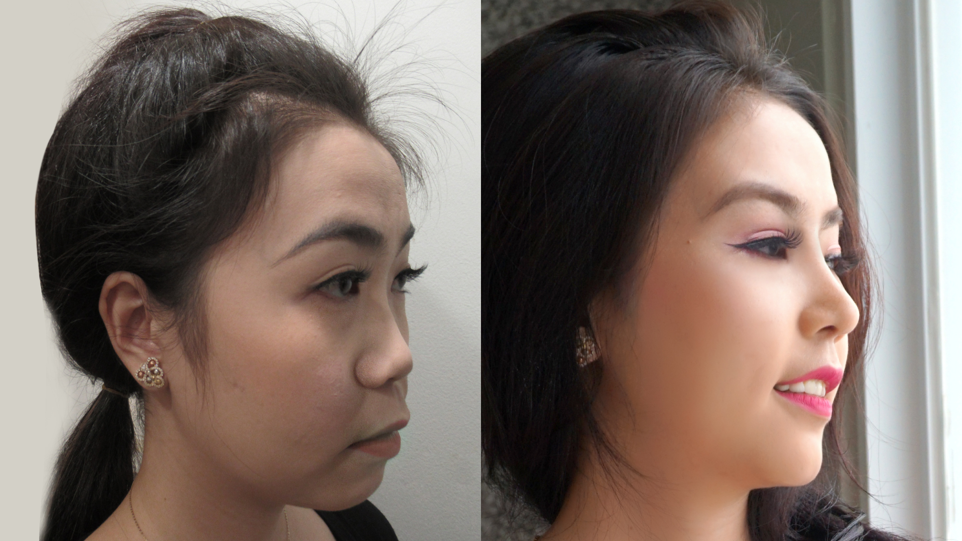 Chân dung vị bác sĩ cứu chữa thành công hàng nghìn trường hợp mũi hỏng - hình 4