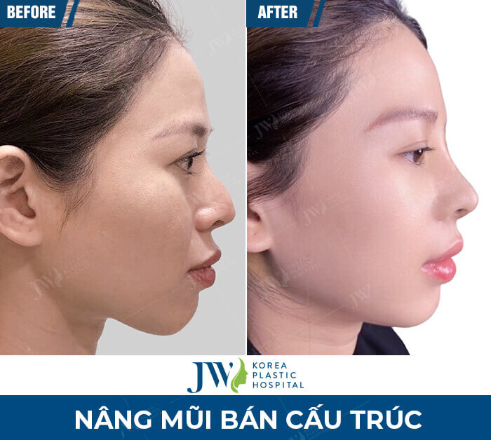 cac dang nang mui