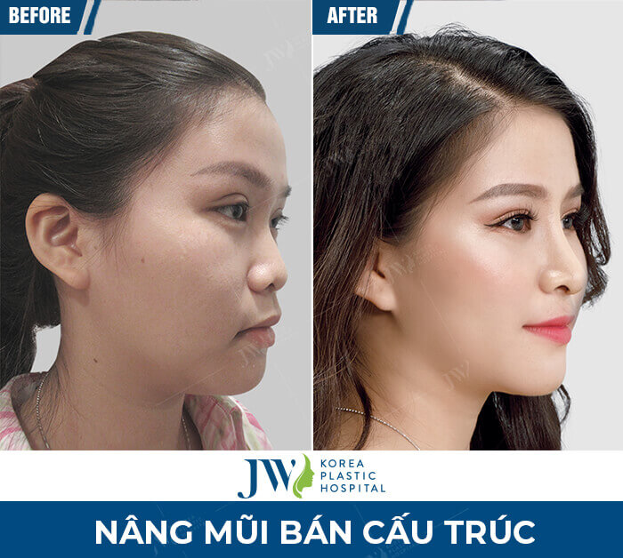 nang mui cho ban