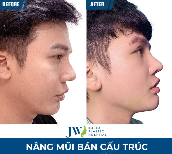 nang mui dep