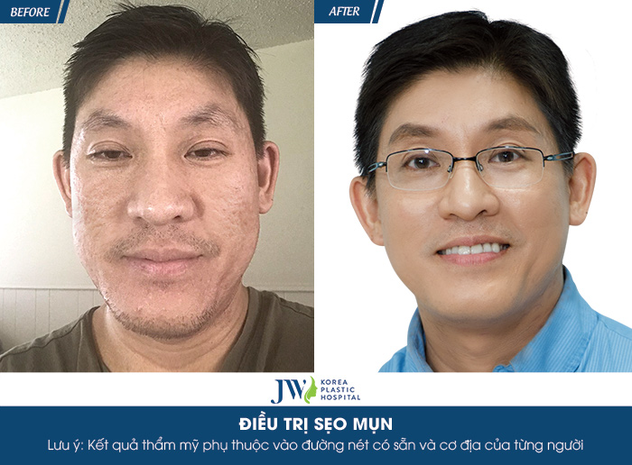 vuot-ngan-cay-so-thay-giao-viet-kieu-my-u40-ve-viet-nam-tut-nhan-sac-6
