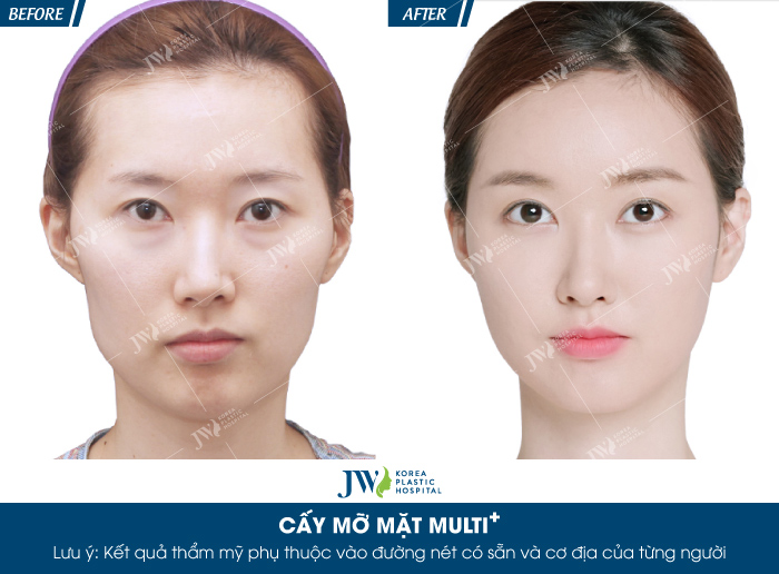 cay-mo-mat-multi-bi-quyet-cho-ve-dep-khong-tuoi-9