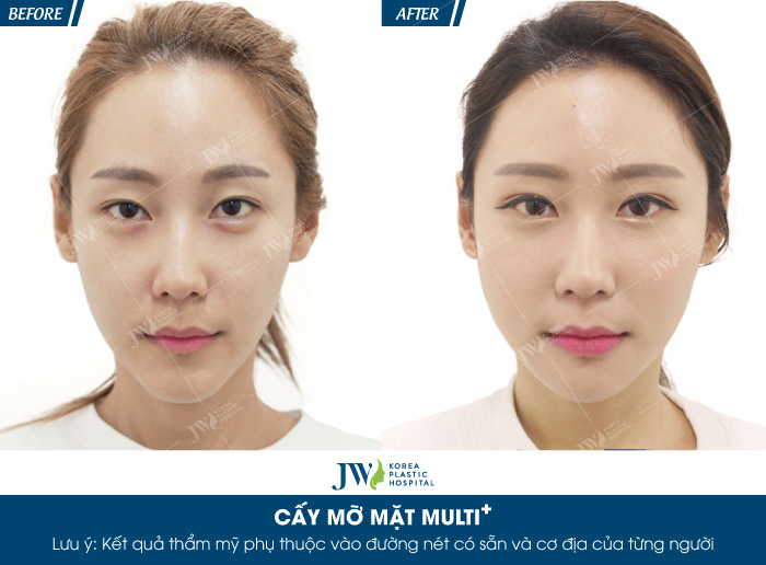 cay-mo-tu-than-o-dau-an-toan-5-tieu-chi-danh-gia-khong-the-bo-lo-7