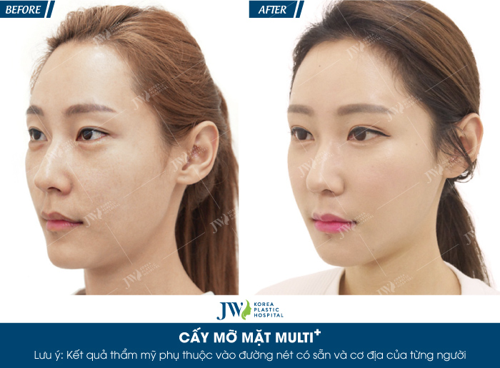 cay-mo-mat-multi-bi-quyet-cho-ve-dep-khong-tuoi-7