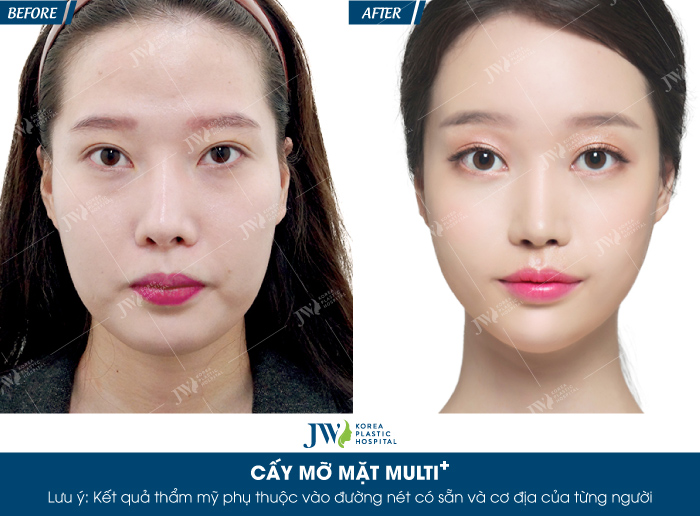 cay-mo-mat-multi-bi-quyet-cho-ve-dep-khong-tuoi-5