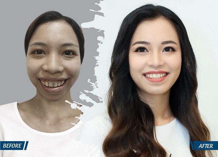 Hàng loạt bạn trẻ được “cứu đời” nhờ phẫu thuật thẩm mỹ - hình 2