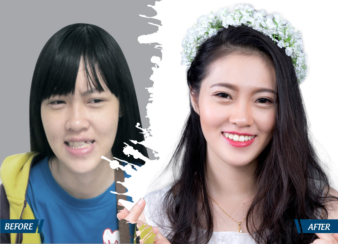 thay đổi nhờ phẫu thuật thẩm mỹ