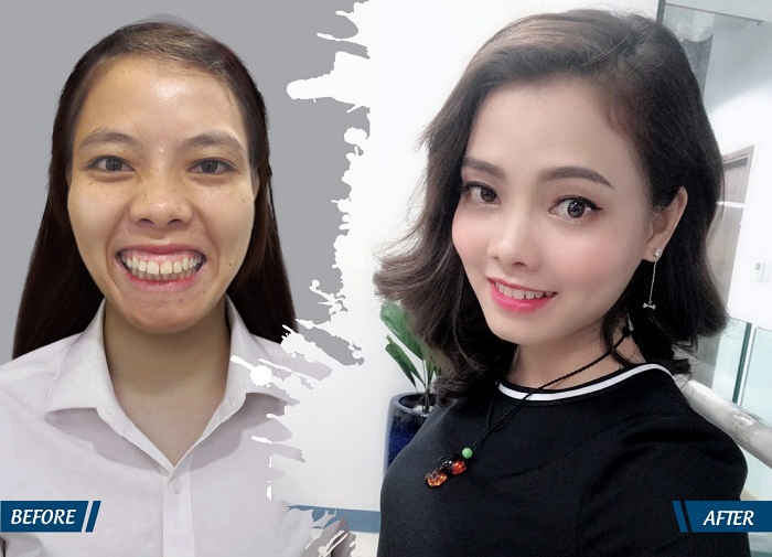Hàng loạt bạn trẻ được “cứu đời” nhờ phẫu thuật thẩm mỹ - hình 4