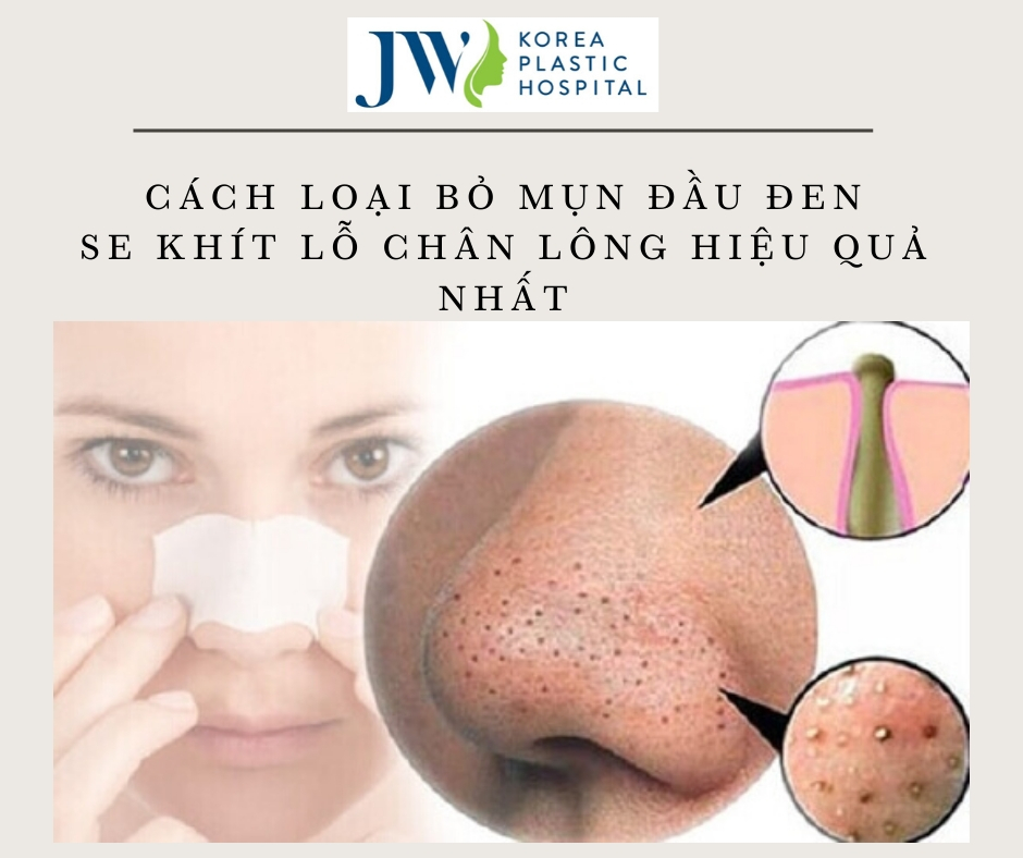 cach-loai-bo-mun-dau-den-se-khit-lo-chan-long-hieu-qua-nhat-1