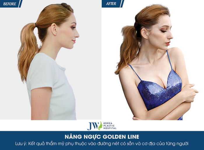 nang-nguc-golden-line2