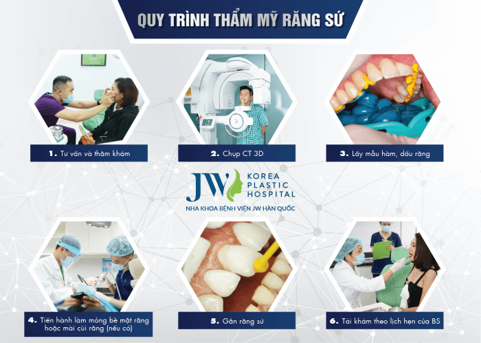 uy-trinh-tham-my-rang-su