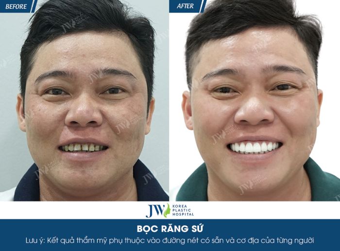 25-12-boc-rang-su