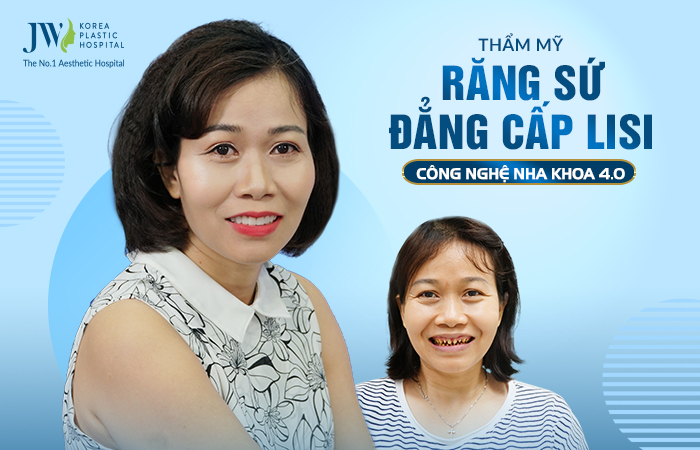 rang-su_doanthinguyen