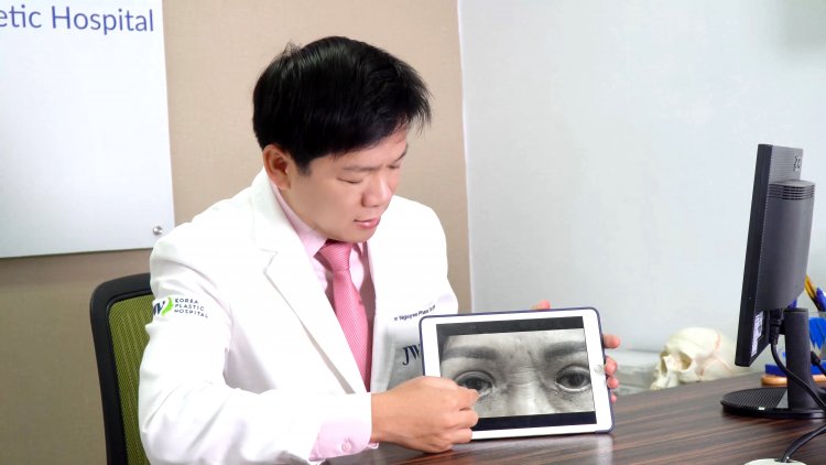 cắt mí mắt, mắt trợn ngược, cắt mắt 2 mí, thẩm mỹ chui, Bác sĩ Tú Dung