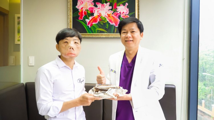 anh mến mặt quỷ