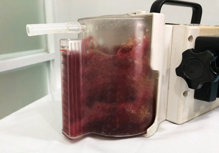 700ml-filler-tu-co-the-benh-nhan