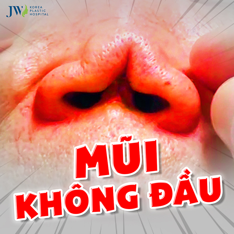 mũi không đầu