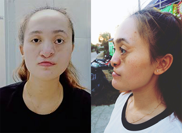 Nhan sắc mới - Khởi đầu mới