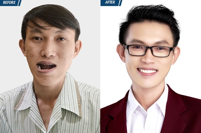 phẫu thuật thẩm mỹ