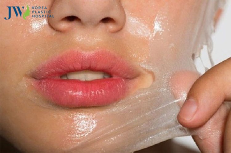 điều trị nám